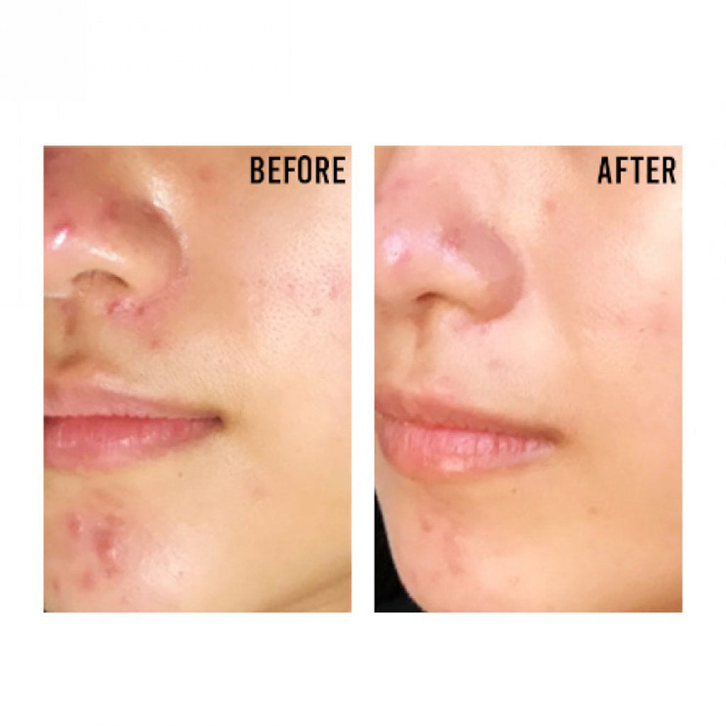 PURITO Centella Unscented Recovery Cream 50 ml