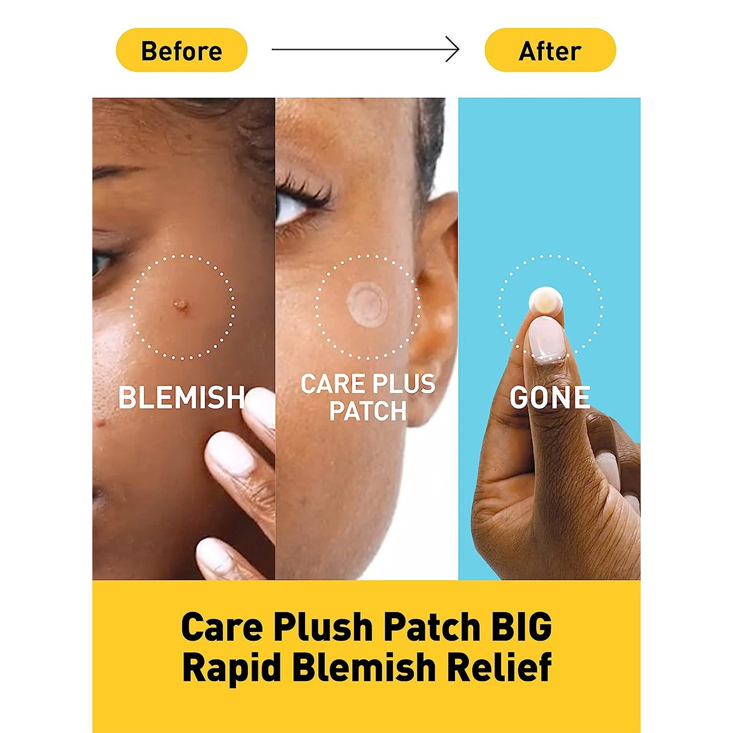 alpha arbutin glutathione whitening cream SHEGAIA Glutathione Whitening Cream for All Skin Types alpha arbutin glutathione whitening cream SHEGAIA Glutathione Whitening Cream for All Skin Types