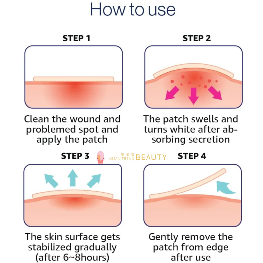 OLIVE YOUNG CARE-PLUS 超薄隐形祛痘贴 81 片